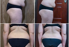 Mix Effect результаты проекта "До/После"