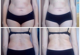 Mix Effect результаты проекта "До/После"